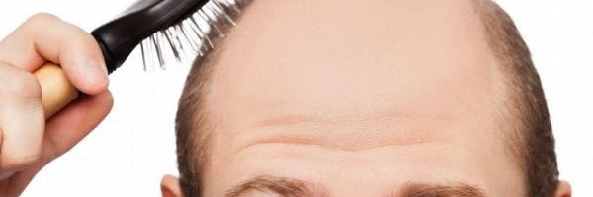 ابتكار-جديد-تحت-التجربة-لتوليد-الطاقة-من-رؤوس-الرجال-الصلع