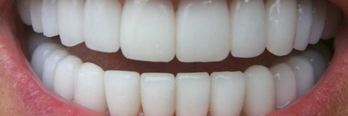 احذر-.-عادات-خاطئة-تدمر-اسنانك