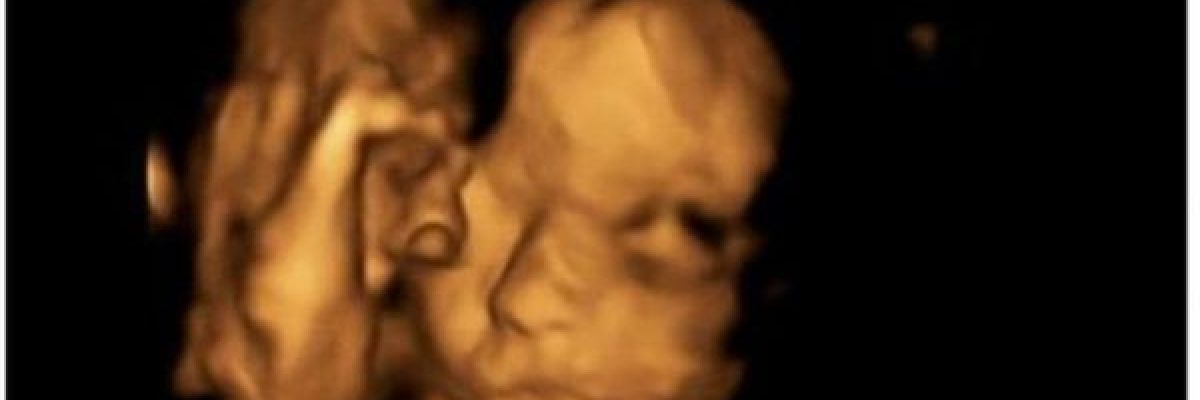 اطباء-يجرون-عملية-جراحية-بالعمود-الفقري-لجنين-في-رحم-امه