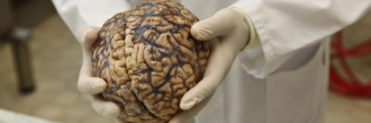 اطباء-يكشفون-ما-يحدث-لدماغ-الانسان-في-لحظة-الموت