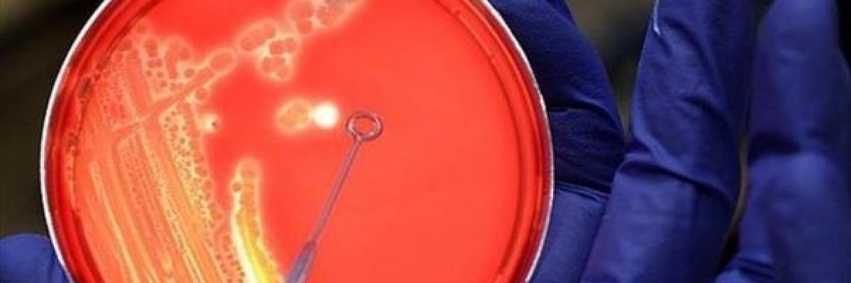 اكتشاف-بكتيريا-قد-تساعد-البشر-على-استعمار-كوكب-المريخ