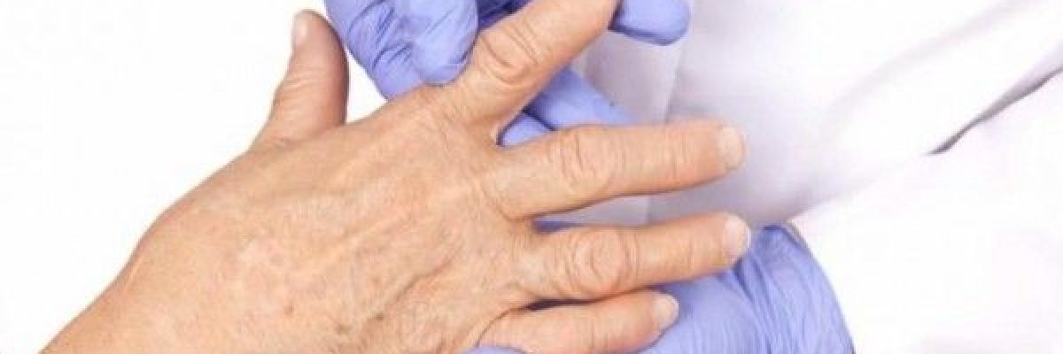 الاقلاع-عن-التدخين-يحد-من-خطر-الاصابة-بالتهاب-المفاصل-الروماتويدي