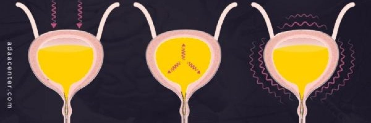 السلس-البولي.-الاسباب-وسبل-العلاج