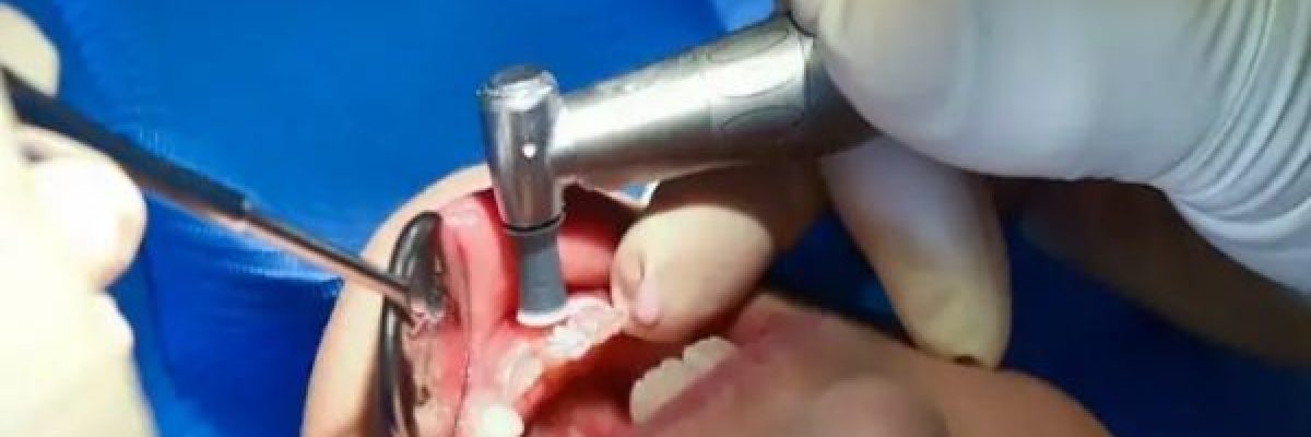 امراض-الفم-والاسنان-قد-تنذر-بخطر-الاصابة-بنوبة-قلبية