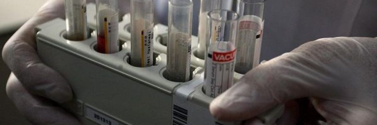 انخفاض-مستويات-الفوسفات-في-الدم-يزيد-خطر-الاصابة-بامراض-القلب