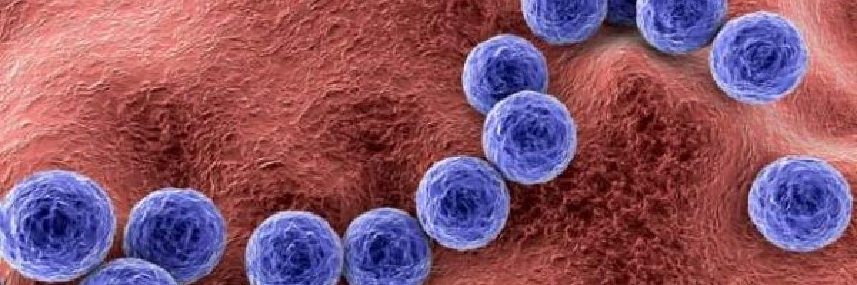 اودى-بحياة-19-مريضاً.-ما-هو-مرض-الفيالقة-المنتشر-في-بولندا؟