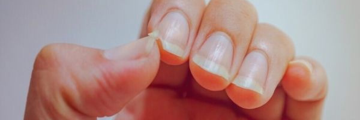 تعرف-على-4-علامات-تظهر-على-اليد-قد-تشير-لاصابتك-بمرض-_السكري_