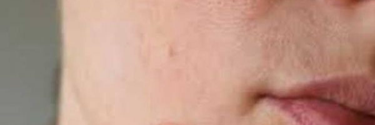 ثلاث-علامات-على-الجلد-تشير-الى-نقص-احد-المغذيات-_الاساسية_-في-الجسم