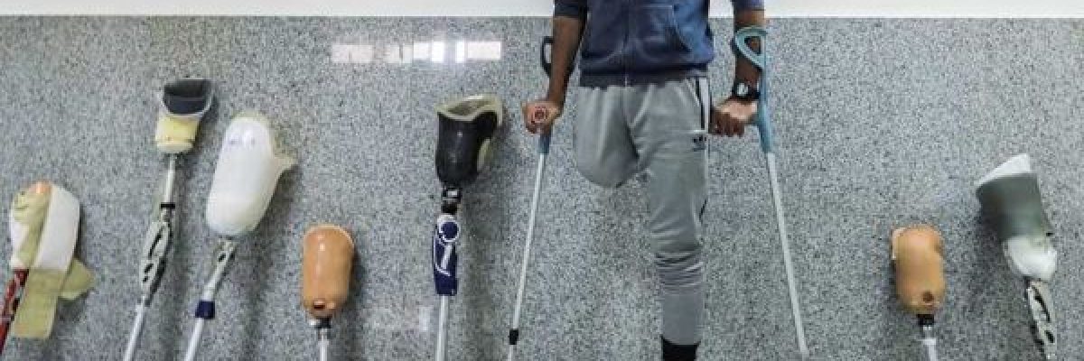 جهود-علمية-لايجاد-طريقة-لتحفيز-_الاطراف-البشرية-على-النمو_