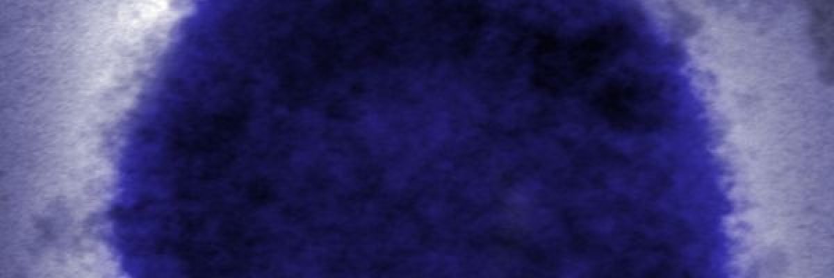 خبراء-يحثّون-على-التاهب-لعرضين-رئيسيين-لجدري-القردة