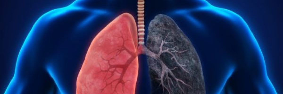 خبراء_-تناول-الفاكهة-والخضراوات-الطازجة-يقيك-من-مرض-الانسداد-الرئوي