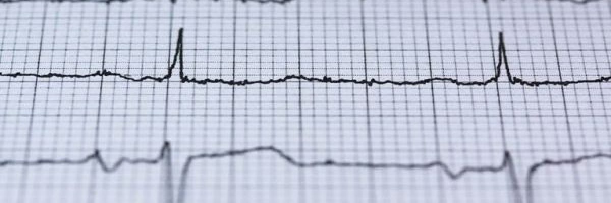 خمس-طرق-تحميك-من-خطر-الاصابة-بنوبة-قلبية-قاتلة