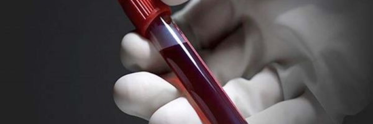 دراسة-تحدد-فئة-الدم-_الاكثر-عرضة-للاصابة-بسكتة-دماغية_