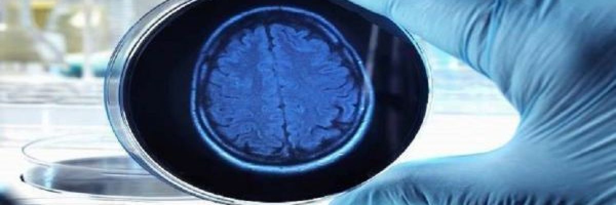 دراسة-تكشف-عن-نظرية-جديدة-حول-المسببات-الاساسية-للزهايمر