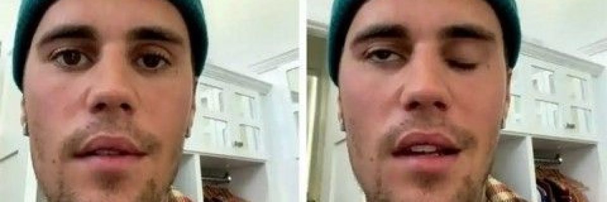 شلل-نصفي-بالوجه.-جاستن-بيبر-يصدم-جمهوره-بفيديو-عن-مرضه