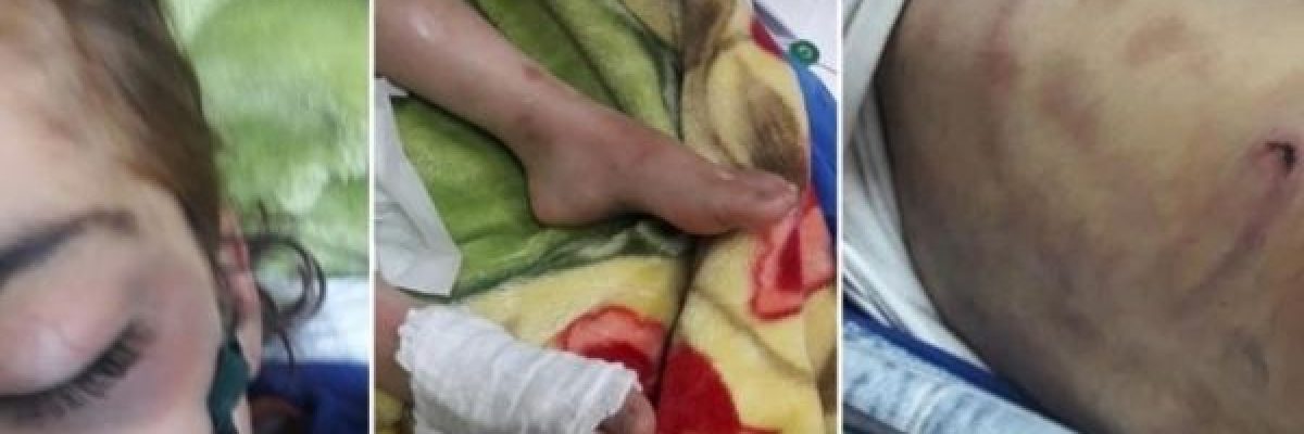 صعقتها-بالكهرباء-واحرقتها.-وفاة-طفلة-بتعذيب-وحشي-من-زوجة-ابيها