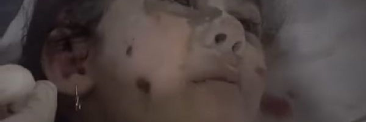 طفلة-جريحة-بغزة-تسال-الطبيب_-عمو.-هذا-حلم-ولّا-بجد؟