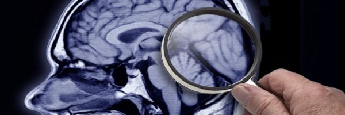 عقار-معتمد-لمرض-مستعصٍ-قد-يعالج-الزهايمر