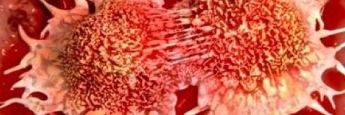 علماء-يطورون-وسيلة-حديثة-لقتل-خلايا-السرطان-فيديو