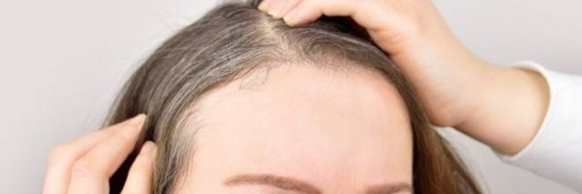 علماء-يكتشفون-ان-التوتر-يؤدي-للشيب-المبكر