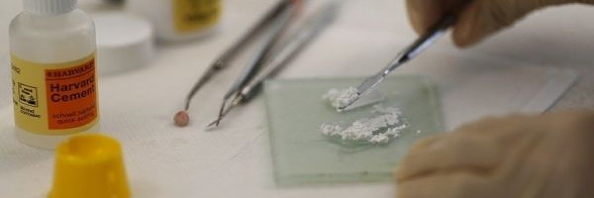 في-حالة-نادرة.-اطباء-يقتلعون-526-سنا-من-فم-طفل-فيديو