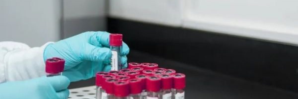 قبل-ظهور-اعراضه-بسنوات.-اختبار-دم-جديد-يمكنه-التنبؤ-بمرض-الزهايمر