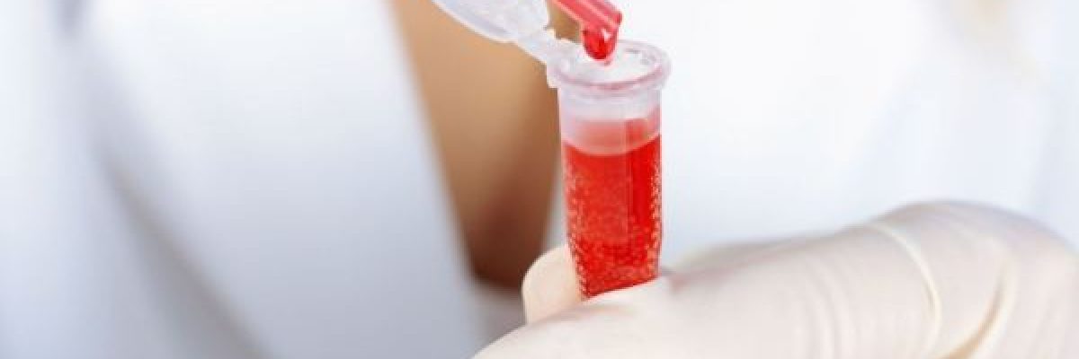 لديك-فصيلة-دم-نادرة-وتريد-تغييرها.-قريباً-يمكنك-فعل-ذلك