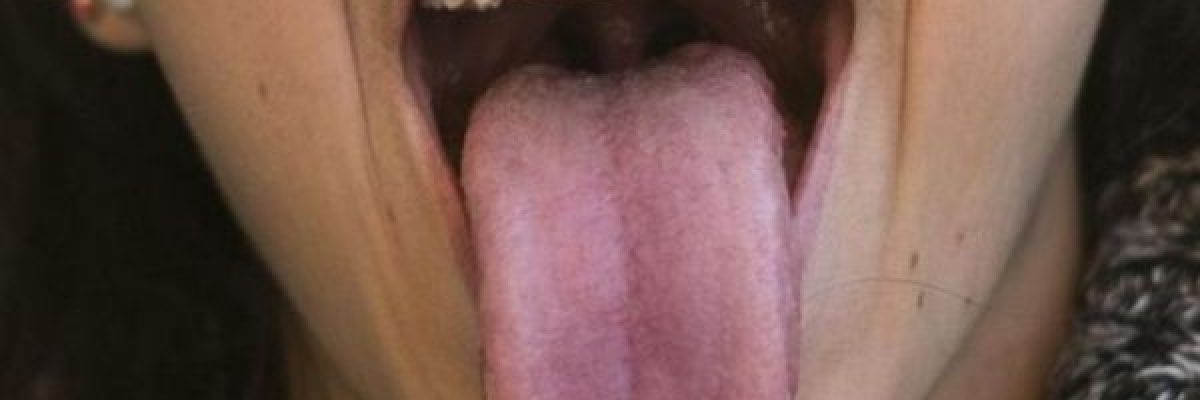 لسانك-يكشف-اسرار-عن-صحتك.-تعرف-عليها