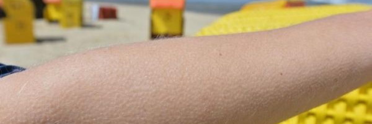 لماذا-نشعر-بالقشعريرة-في-مواقف-معينة؟