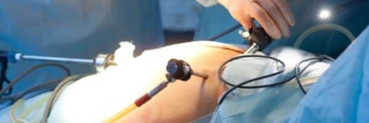 ما-علاقة-جراحات-السمنة-وانقطاع-النفس-الانسدادي-بخطر-الوفاة؟