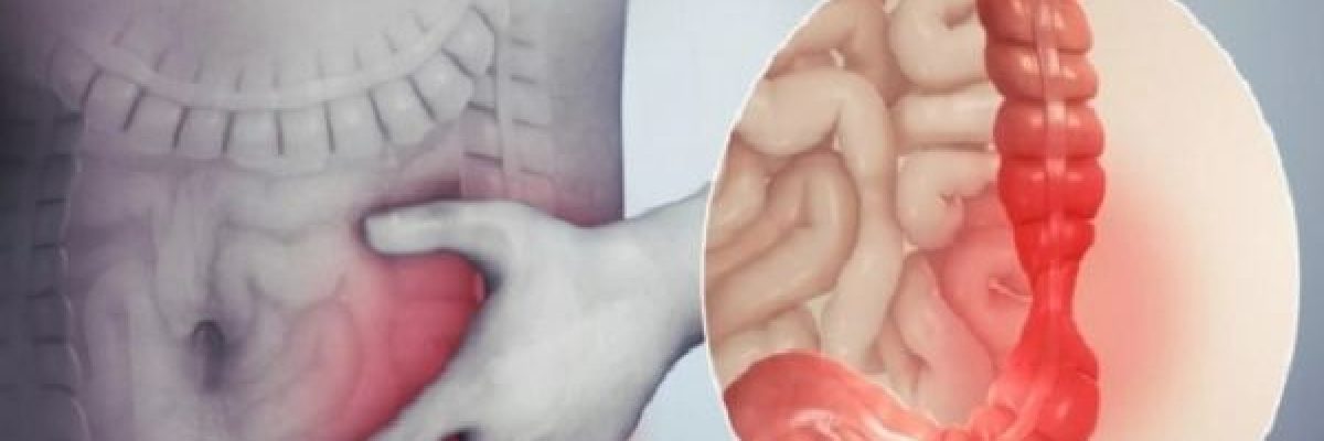 ما-هو-الرابط-بين-القولون-العصبي-والقلق؟