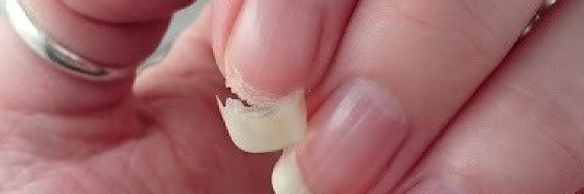 ماذا-تخبرنا-_الاظافر-الشاحبة_-عن-الكولسترول؟