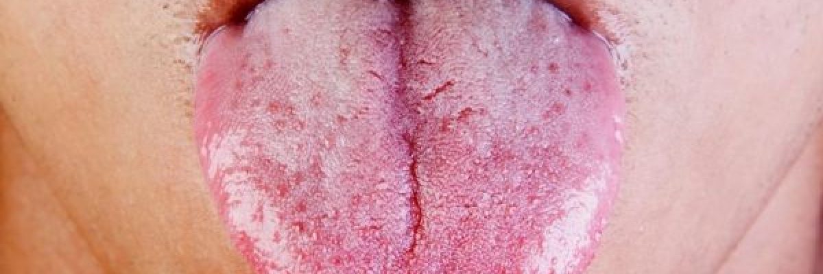 ماذا-تكشف-لسانك-عن-صحتك