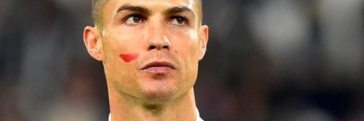 ماهو-سر-العلامة-الحمراء-في-وجه-رونالدو؟