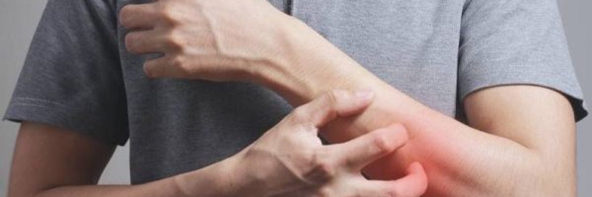 نصائح-طبية-مهمة-للحفاظ-على-صحة-الجلد-في-الصيف