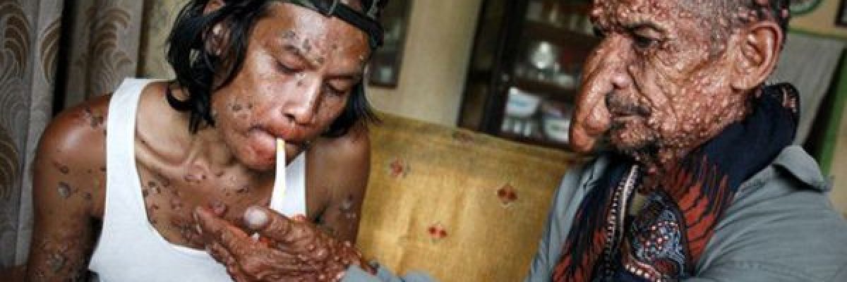 نهاية-ماساوية-لقصة-الرجل-الشجرة-صور