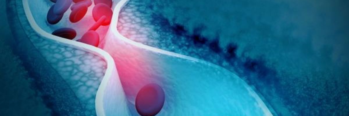 هذه-الفاكهة-تقلل-الكوليسترول-وتحمي-القلب