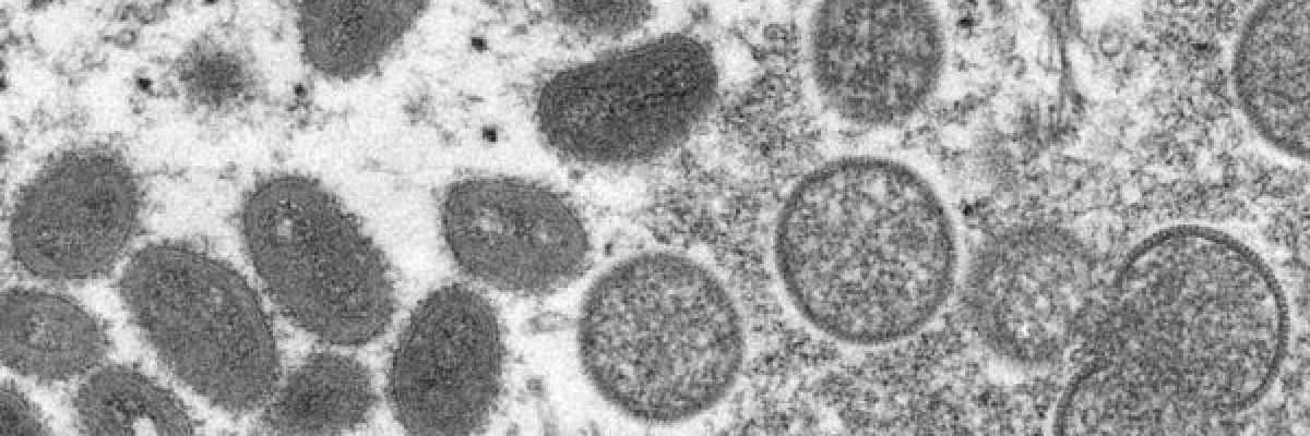 هل-ينبغي-القلق-من-جدري-القردة؟